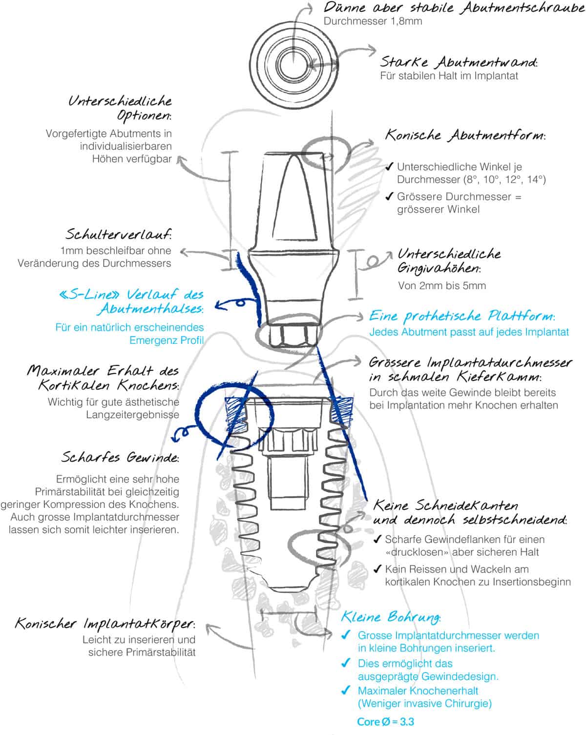 anyRidge-Vorteile-Skizze-1