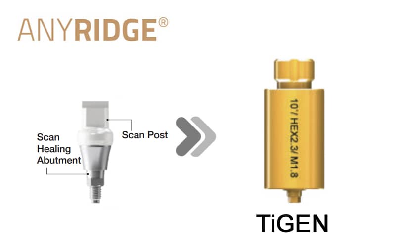 AnyRidge SHA TiGEN(Pre-milled)