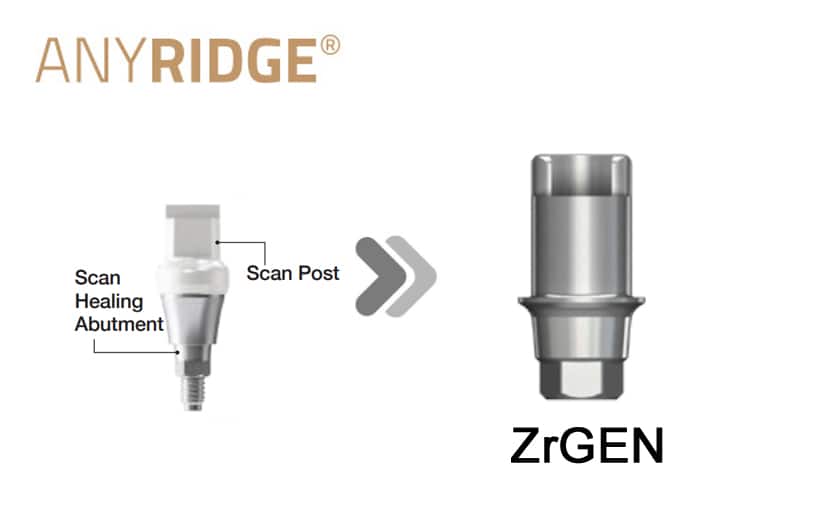 AnyRidge SHA ZrGEN(Ti-base)