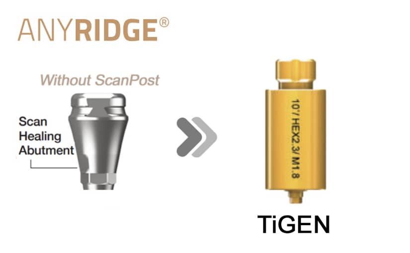 AnyRidge SHA(Without post) TiGEN(Pre-milled)