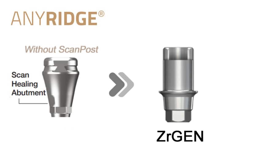 AnyRidge SHA(Without post) ZrGEN(Ti-base)