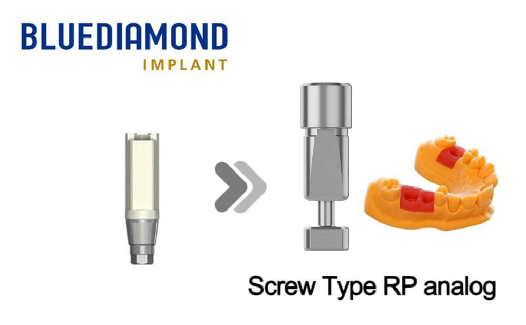 BlueDiamond-ScrewTypeRP-analog