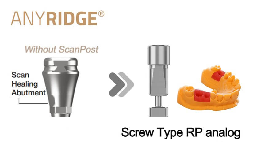 AnyRidge SHA (without post) RP(3D print model)