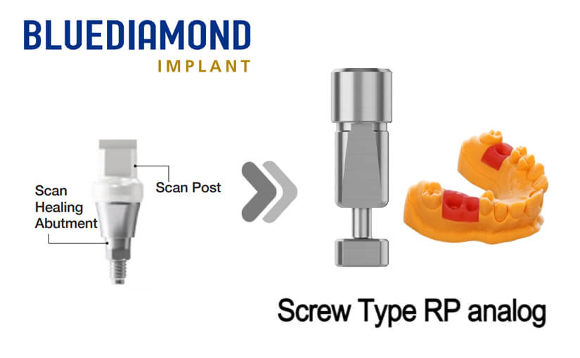 BlueDiamond SHA_RP_Screw type (3D print model)