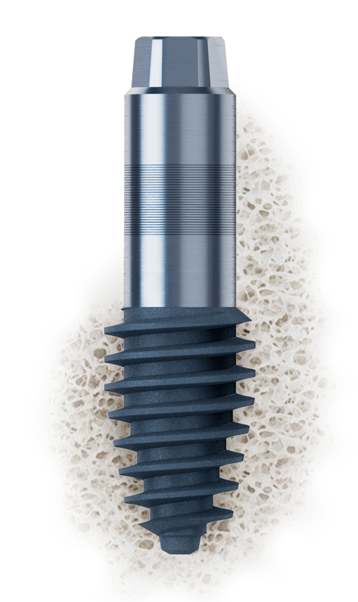 ARi Dental Implantat